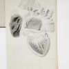<span class="artist-name-product">BOUILLAUD  Jean Baptiste</span> Traité clinique des maladies du cœur, précédé de Recherches nouvelles sur l'anatomie et la physiologie de cet organe. - Image 2